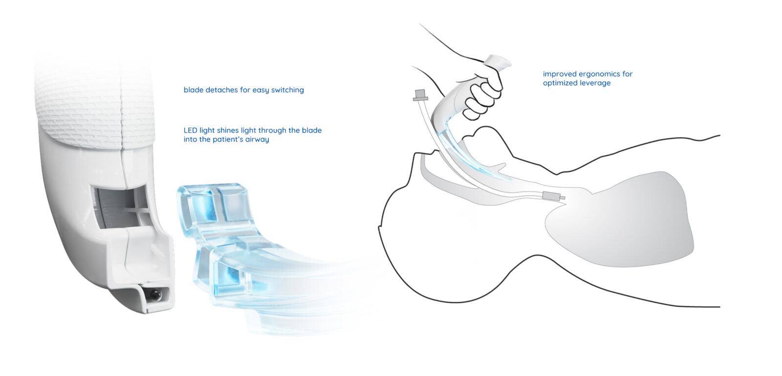 The final solution for the redesigned Laryngoscope